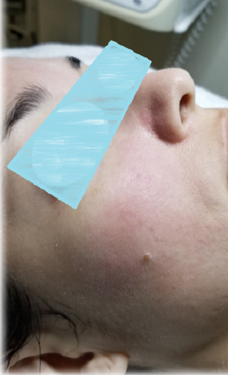 After image
