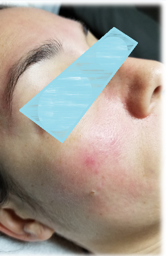 Before image