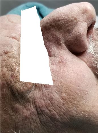 After image