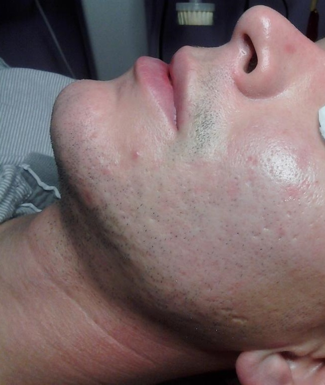 After image